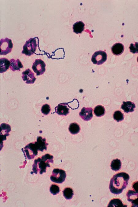 Streptococcus Viridans Microbewiki