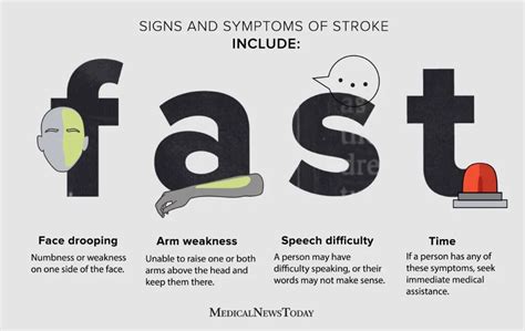 Signs Of Stroke In Men Early Warnings And Symptoms