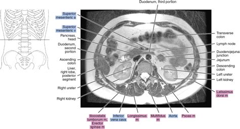 Mri Of The Abdomen Radiology Key