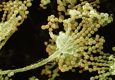 Aspergillus Fungus Photograph By Ami Imagesscience Photo Library Pixels