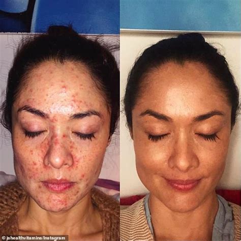 Women Share Incredible Before And After Photos After Using £30 Miracle