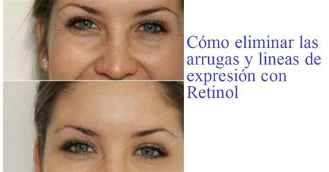 Jun 17, 2020 · las cremas para la cara son parte de los productos más antiguos en la industria cosmética. Retinol el mejor para eliminar las arrugas y lineas de ...