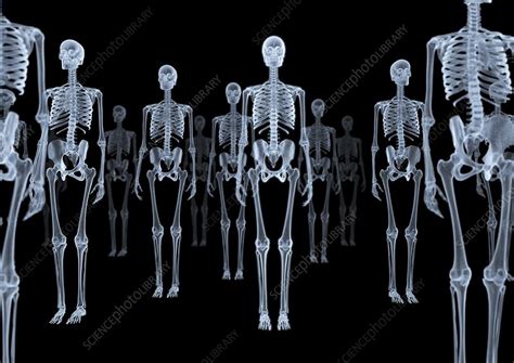Skeletons X Ray Artwork Stock Image P1000276 Science Photo Library