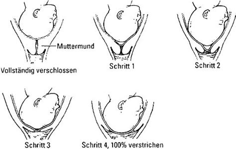 Wie bemerkst du eine vorzeitige öffnung des hast du das gefühl, dass sich dein muttermund vorzeitig öffnet, solltest du in jedem fall deinen frauenarzt konsultieren. Erkennen, wann Wehen echt sind und wann nicht ...