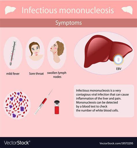 Infectious Mononucleosis Causes Signs And Symptoms Diagnosis And My