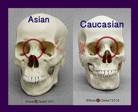 The Difference Between Asian And Caucasian Eyes Skull Anatomy Facial