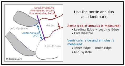 This Week We Will Discuss The Aorta And Review The Morphology And The