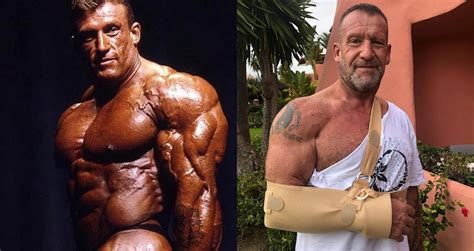 Dorian Yates Dislocates Shoulder In Bike Riding Accident