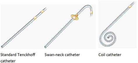Simplified Medical Placement Of Tenckhoff Catheter Under Local