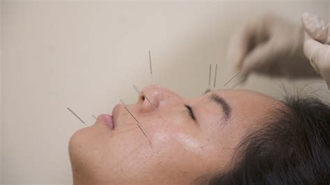 Facial Acupuncture 101 Youtube