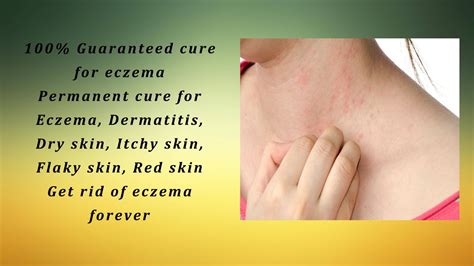 Permanent Cure For Eczema Dermatitis Dry Skin Itchy Skin Flaky Skin