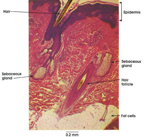 Learn about the skin's function and conditions the skin protects us from microbes and the elements, helps regulate body temperature, and permits the sensations of touch, heat, and cold. Plate 7.145 Scalp