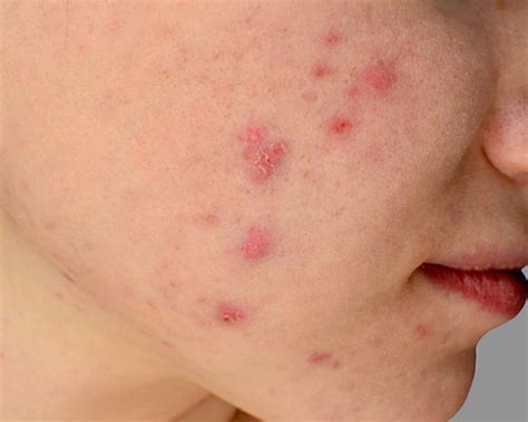Top Skin Disorders A Dermatologist Encounters