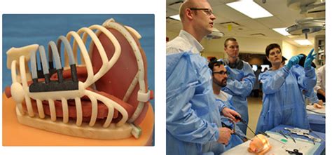 Surgeons 3d Print Rib Cages To Help In Pediatric Surgeries