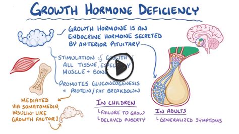 Pituitary Dwarfism Gh Deficiency Lecture Smarty Pance