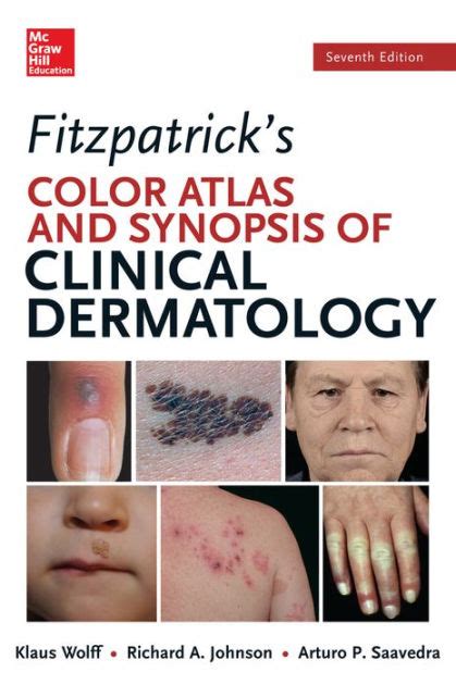 Fitzpatricks Color Atlas And Synopsis Of Clinical Dermatology Seventh