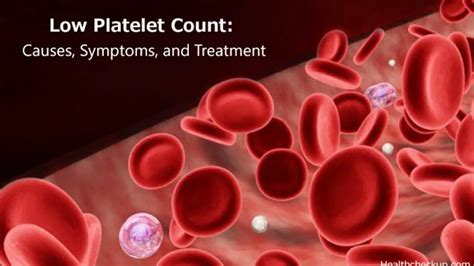 Low Platelet Count Thrombocytopenia Causes And Symptoms Healthtian