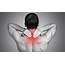 Weak Neck Muscles May Cause Joint Pain In Legs  Chiropractor York PA