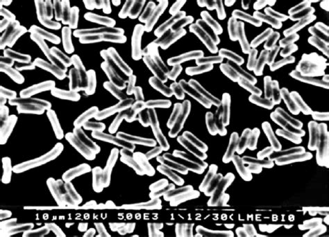 Micrograph Of Bacillus Subtilis Fig Micrograph Of Bacillus The Best The Best Porn Website