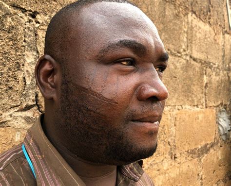 Nigerias Facial Scars The Last Generation Bbc News