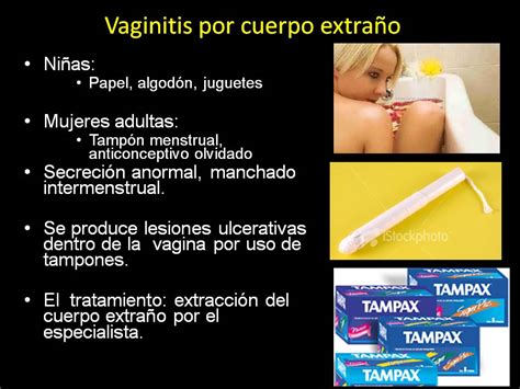 Salud Para La Mujer Y El Hombre Infecciones Vaginales Que Son Y Como