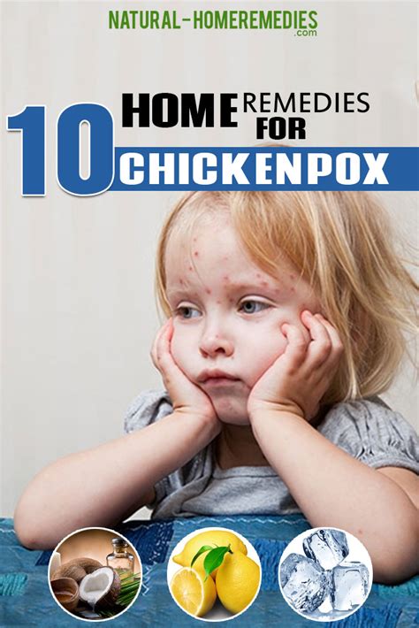 10 Home Remedies For Chickenpox Natural Home Remedies And Supplements