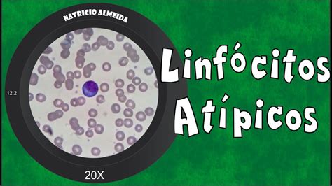 O Que São Linfócitos Atípicos