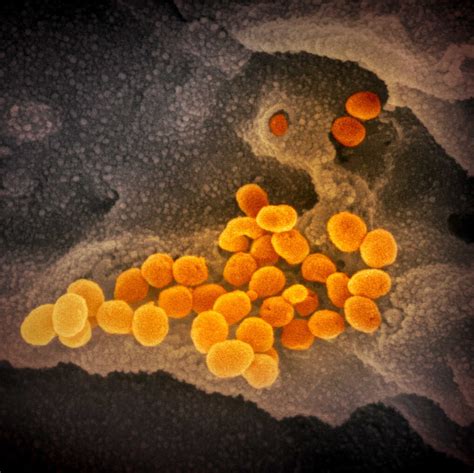 Images What New Coronavirus Looks Like Under The Microscope Npr