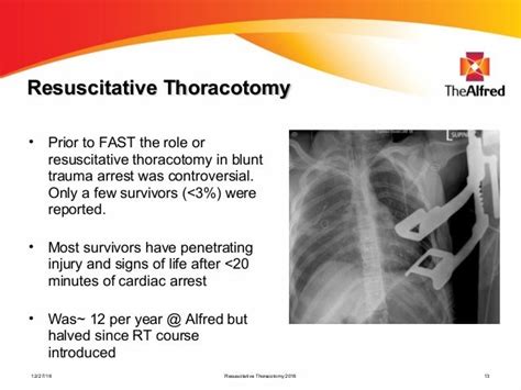 Resuscitative Thoracotomy Mark Fitzgerald