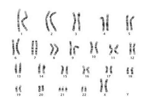 As Anomalias Cromossomicas Sao Bastante Frequentes Na População Humana