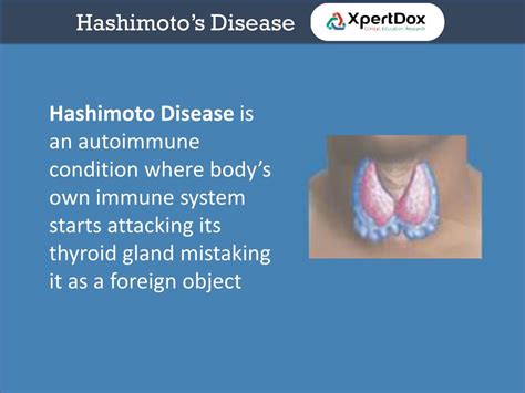 Ppt Hashimotos Disease Powerpoint Presentation Free Download Id