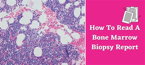 How To Read A Bone Marrow Biopsy Report All Information