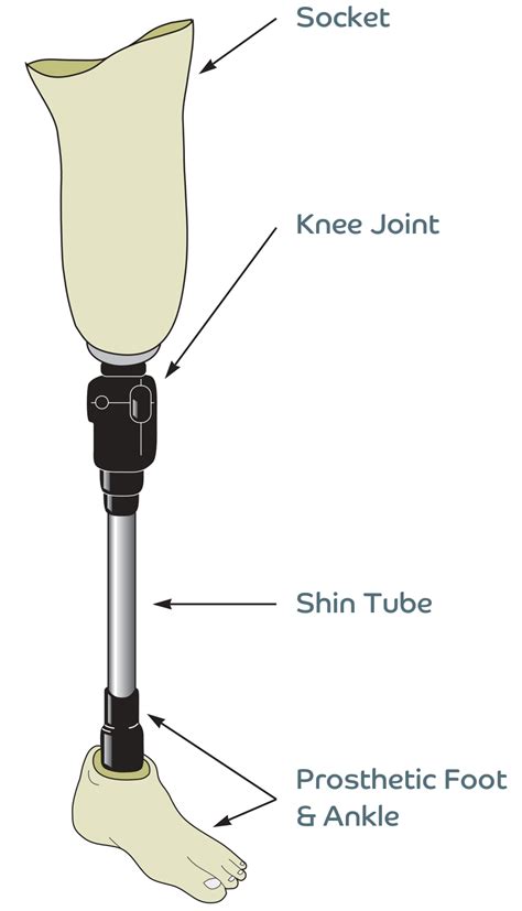 Above Knee Prosthesis Endolite