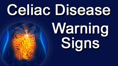 Celiac Disease Warning Signs Youtube