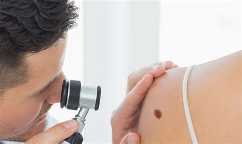 Skin Cancer Clinic In Melbourne Book Now Mole Check Clinic