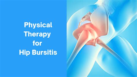 Bursitis — Blog Mangiarelli Rehabilitation