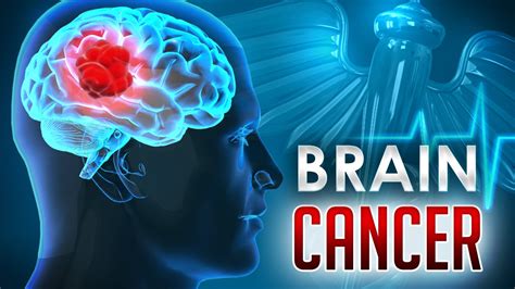Brain Cancer Replaces Leukemia As Deadliest Cancer For Kids Study