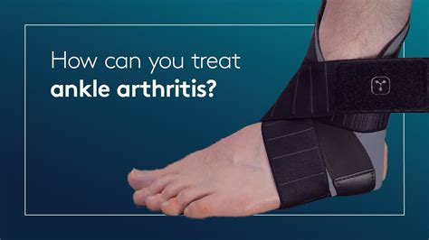 How Can You Treat Ankle Arthritis Youtube