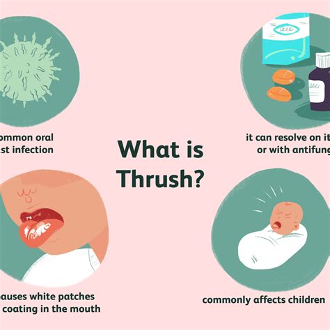 Oral Thrush