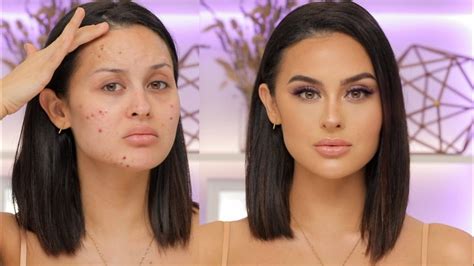 Flawless Skin Transformation With Makeup For Acne Breakouts - Christen
