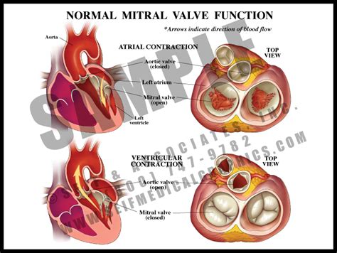 Normal Valve Function Sanda Medical Graphics