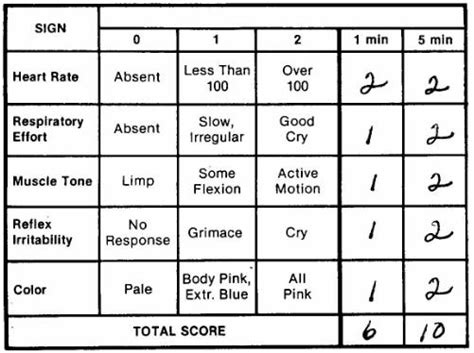 Apgar Scoring System Chart A Visual Reference Of Charts Chart Master