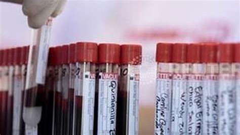 Blood Test Can Predict Life Expectancy Study News Khaleej Times