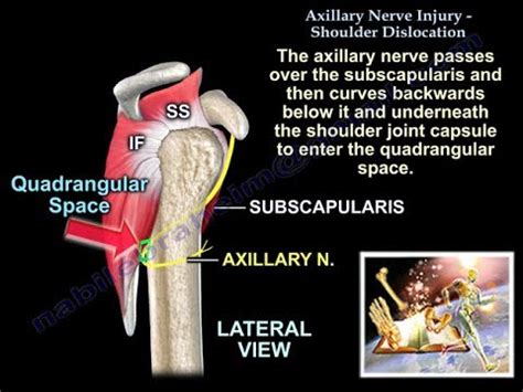 Axillary Nerve Injury Shoulder Dislocation Everything You Need To