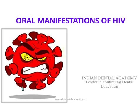 Oral Manifestations Of Hiv Aids Dental Implant Courses