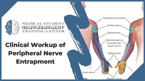 Clinical Workup Of Peripheral Nerve Entrapment Youtube