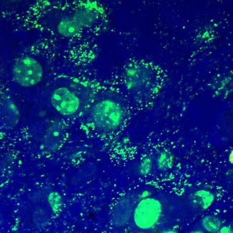 Mycoplasma Contaminated Eukaryotic Cells Stained With A Fluorescent Dna