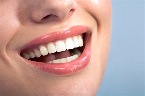 Comprehensive Dentistry Centerton Ar Caring For Dental Veneers 5