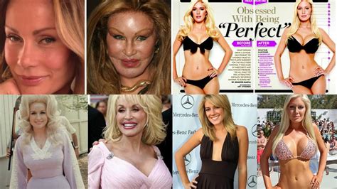 Shocking Celebs Before And After Plastic Surgery Youtube
