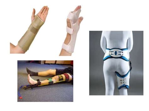 Bandaging And Splinting And Slings Techniques And Types Health Subjec